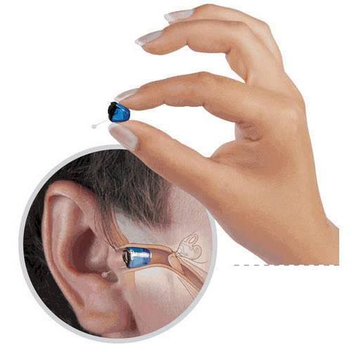 Invisible Hearing Aids